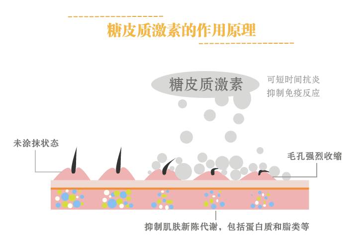 怎么测化妆品里有没有激素_有激素化妆品怎么检查_有激素的化妆品怎么辨别