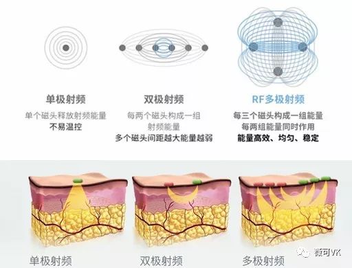 腹部震动器减腹部脂肪好用吗_腹部震动仪能减脂吗_震动健腹器有效果吗