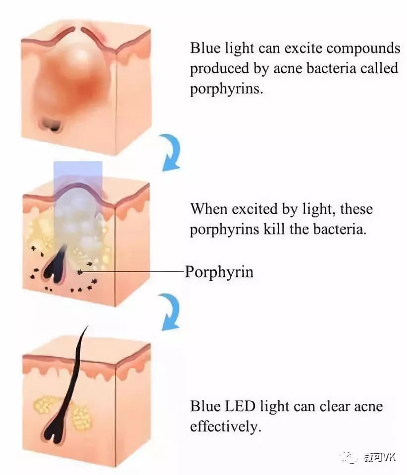 腹部震动器减腹部脂肪好用吗_腹部震动仪能减脂吗_震动健腹器有效果吗