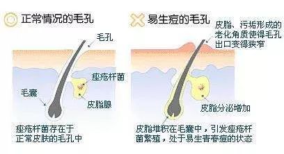 婴儿按摩油可以涂脸吗_婴儿按摩油可以刮痧吗_婴儿油可以当按摩油私