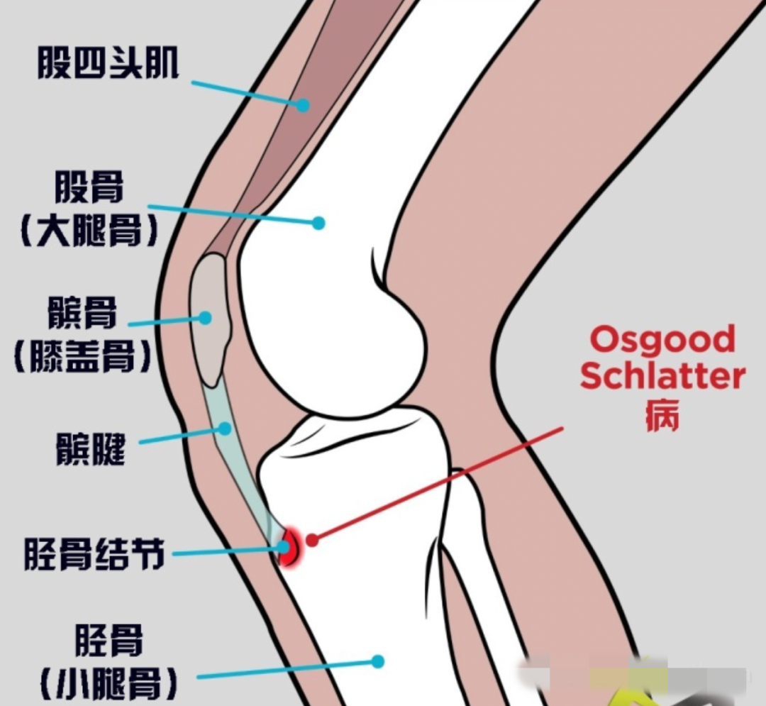 每天跳绳能长多高_每天跳绳会长高多少_跳绳每天跳超过1000下能长高吗