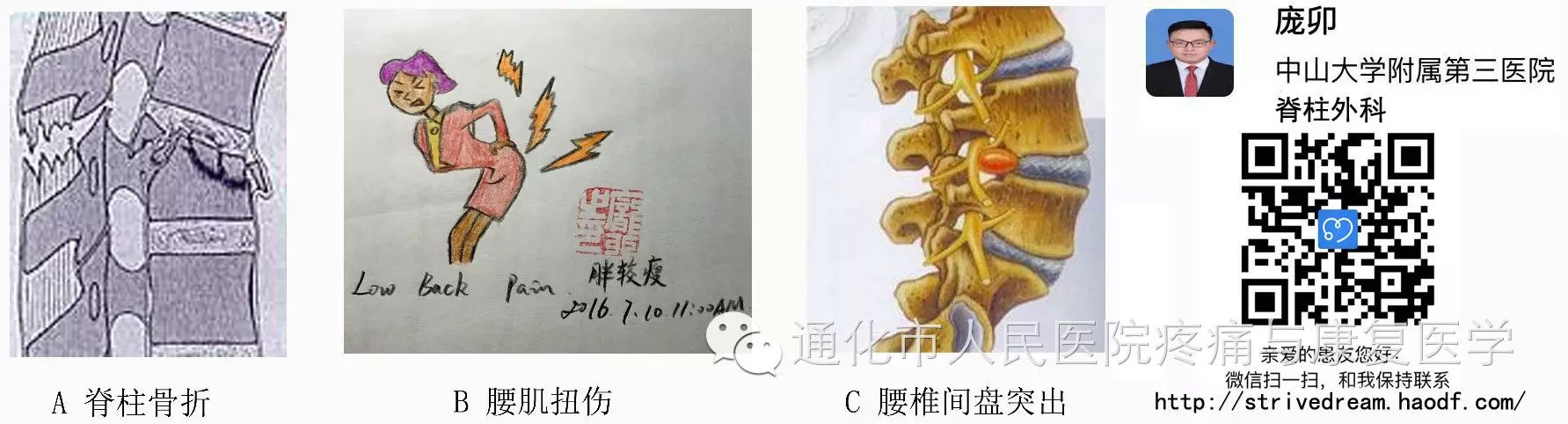 36女性犯腰椎间盘突出腰围固定带要24小围着?_腰围固定器的作用_腰围带对椎间盘突出有作用吗