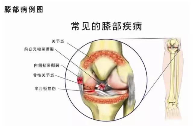 微信计步器会不会有延迟_微信有走路计步器在哪_微信计步器的工作原理