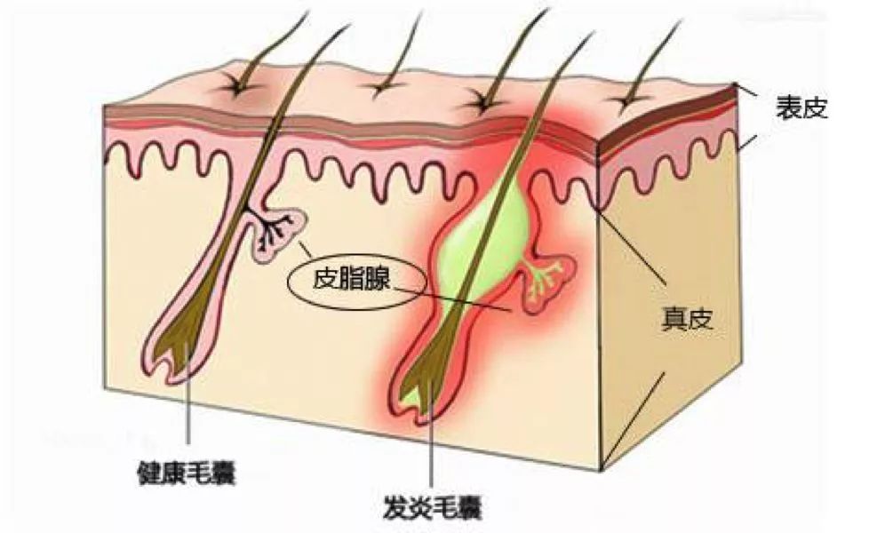 身体出现死皮_身上死皮是什么_身体死皮是什么原因