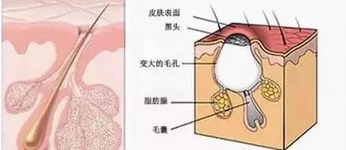 身上死皮是什么_身体出现死皮_身体死皮是什么原因