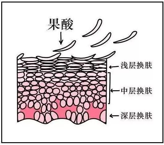 身上死皮是什么_身体出现死皮_身体死皮是什么原因