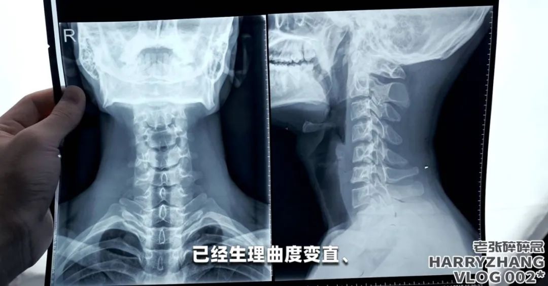 健身椅训练动作_健身椅怎么选_健身椅推荐知乎