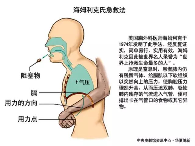 用醋洗头必须用白醋吗_用醋精洗头有没有作用_洗头用醋精好吗