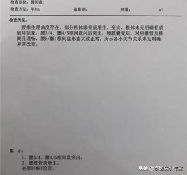 腰间盘突出怎么锻炼好_腰间盘突出锻炼好不好_腰间盘突出是锻炼好还是休息好